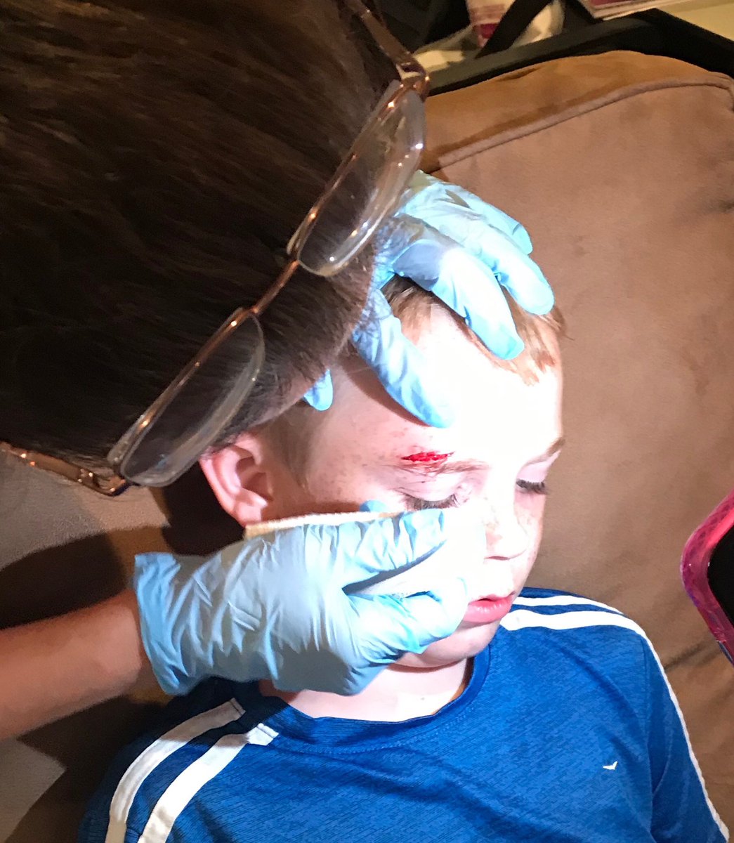mduanemd's tweet photo. This is what happens when a child falls off a trampoline at 1:45pm &amp; then when you have a #DPC doctor who can see you immediately! Again #DirectPrimaryCare for the win saving Mom from spending hours at urgent care! ⁦@MMMedCare⁩
⁦@dpcalliance⁩ ⁦@faithfulMDcoach⁩ https://t.co/qXgrvgd1a4