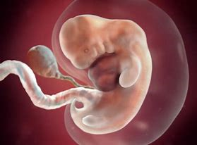 LenkaPariz's tweet photo. @LiveAction Late-term ultrasound's deceptive(may violate HIPAA)
*90% abortions ocurr <13 weeks
*65% of those ocurr <8 weeks (fetus the size of kidney bean) 
*6 week human &amp; dog fetuses, which is which🤔
*25% women miscarry child they WANT; LiveAction=¯\_(ツ)_/¯
*See also Institutional Autism https://t.co/DhkEMAJ5f6