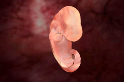 LenkaPariz's tweet photo. @LiveAction Late-term ultrasound's deceptive(may violate HIPAA)
*90% abortions ocurr <13 weeks
*65% of those ocurr <8 weeks (fetus the size of kidney bean) 
*6 week human &amp; dog fetuses, which is which🤔
*25% women miscarry child they WANT; LiveAction=¯\_(ツ)_/¯
*See also Institutional Autism https://t.co/DhkEMAJ5f6