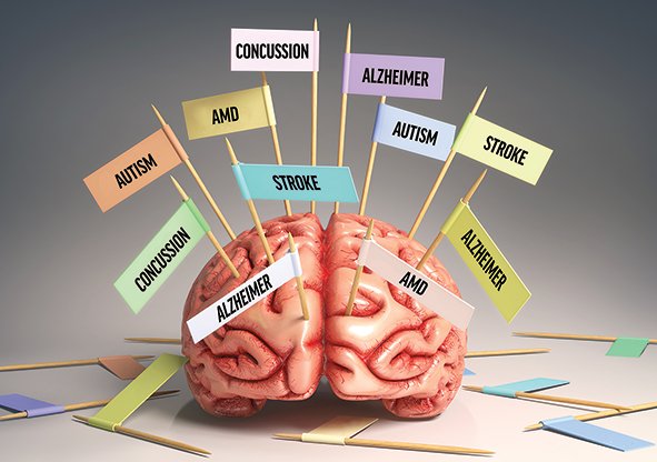 ModOptometry's tweet photo. Assessing a patient’s visual performance helps to determine which area of the brain an insult has affected most. Learn how to use the visual system to guide improvement in visual and cognitive performance here: https://t.co/sBbvFB7DB6 #Optometry #NeuroOptometry @VTODdoc https://t.co/ak4OoUNm0q