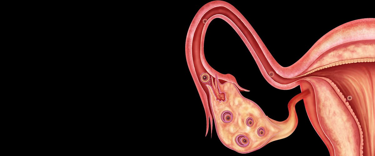 Interna81585298's tweet photo. https://t.co/y3TkblwXv3
We welcome all of you to our upcoming international conference on Gynecologic Oncology 2019 which includes #Gynecology  #Reproductive disorders #Endometrial #Cancerthearapy2019 @malaysia https://t.co/Er311prnJn