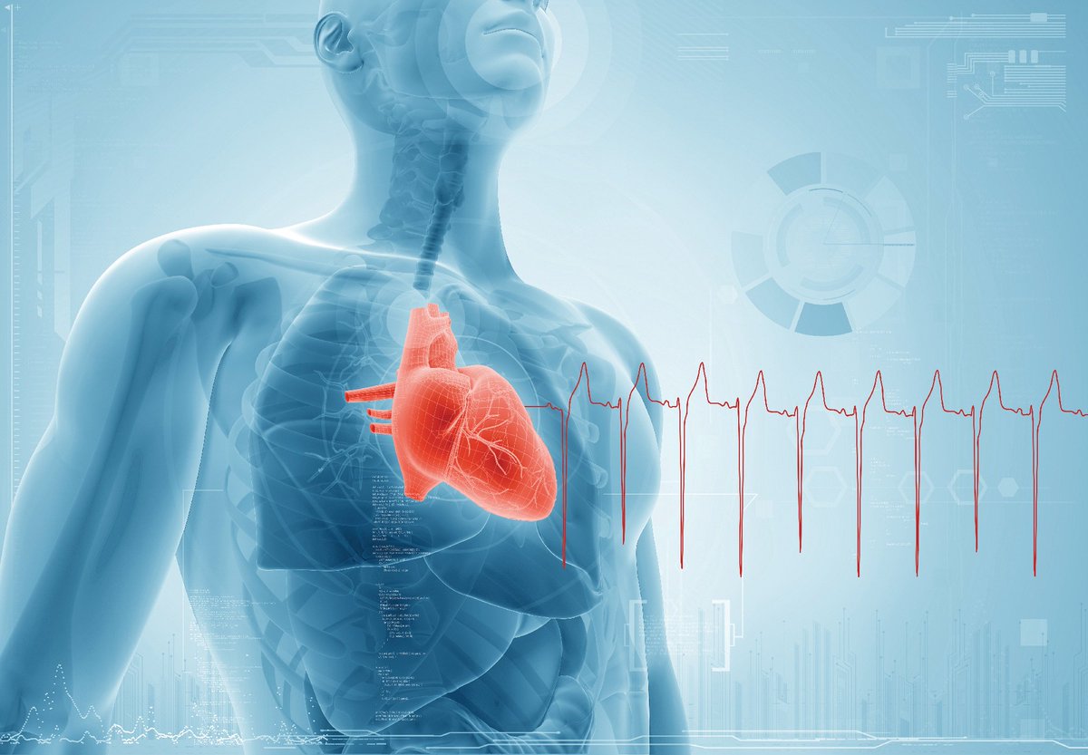 More than one in 10 over 75-year-olds now have chronic heart failure. Join us on the 18th June at 7pm (AEST) to get the latest on Australian heart failure guidelines and learn how they differ from international guidance. ausdoc.com.au/category-2/chf…