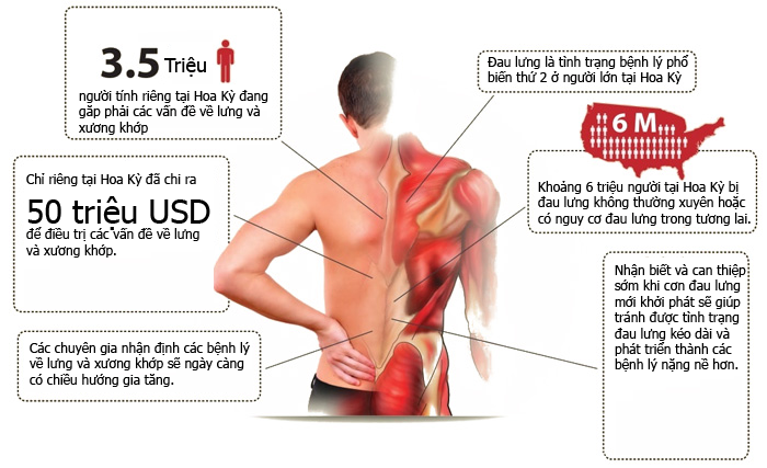Johnson44660267's tweet photo. KIỂM SOÁT CÁC LOẠI ĐAU LƯNG KHÁC NHAU
==============================================
#johnsonfitness
#ghemassagetoanthan
#uudiemvanhuocdiem
==============================================
https://t.co/TtXNDehvvR https://t.co/o1RUl1NgBx