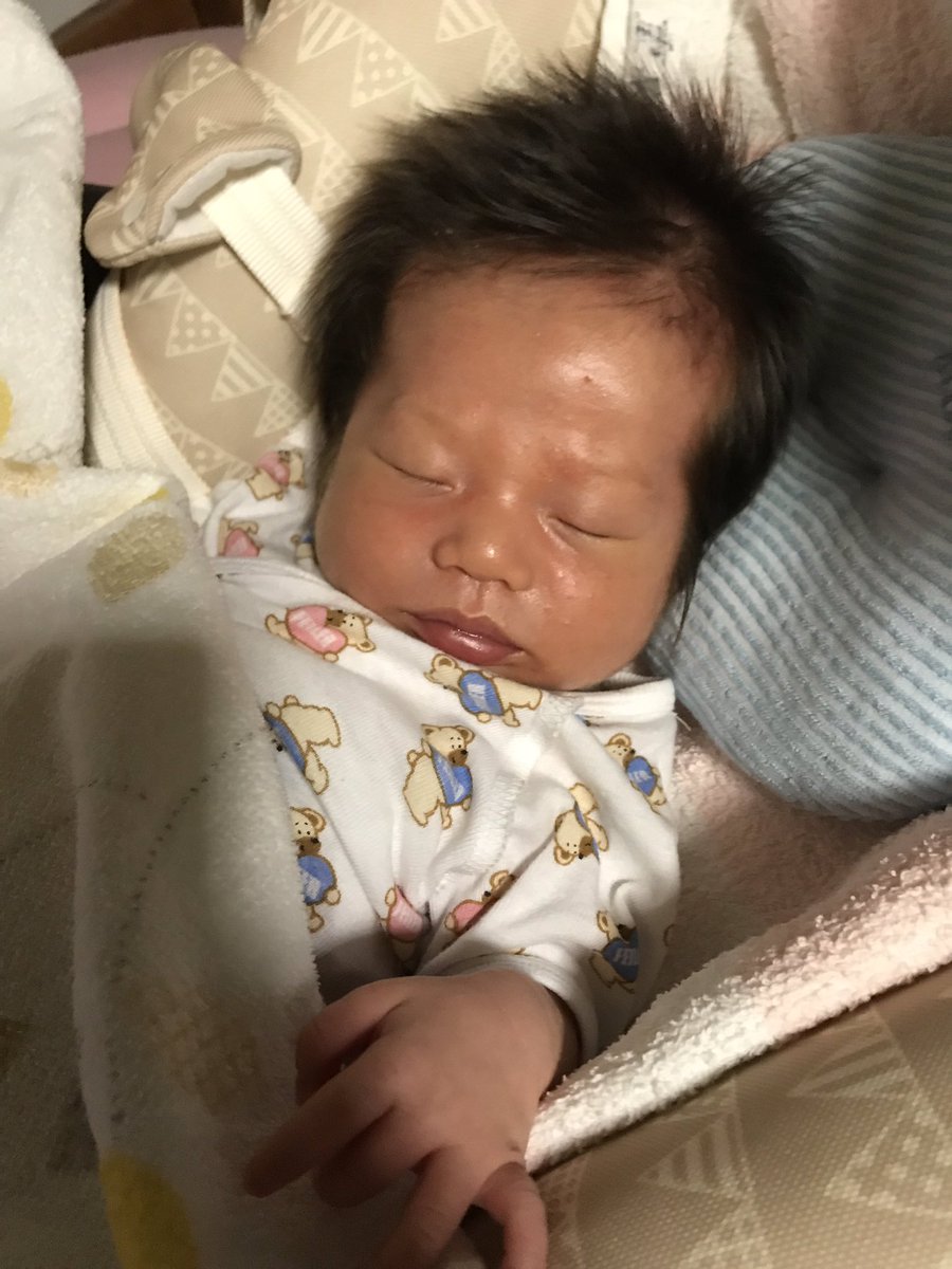 しげお あくらい 公式 しかし1ヶ月でここまで顔がパンパンに膨れるくらい太るとは想像してなかった