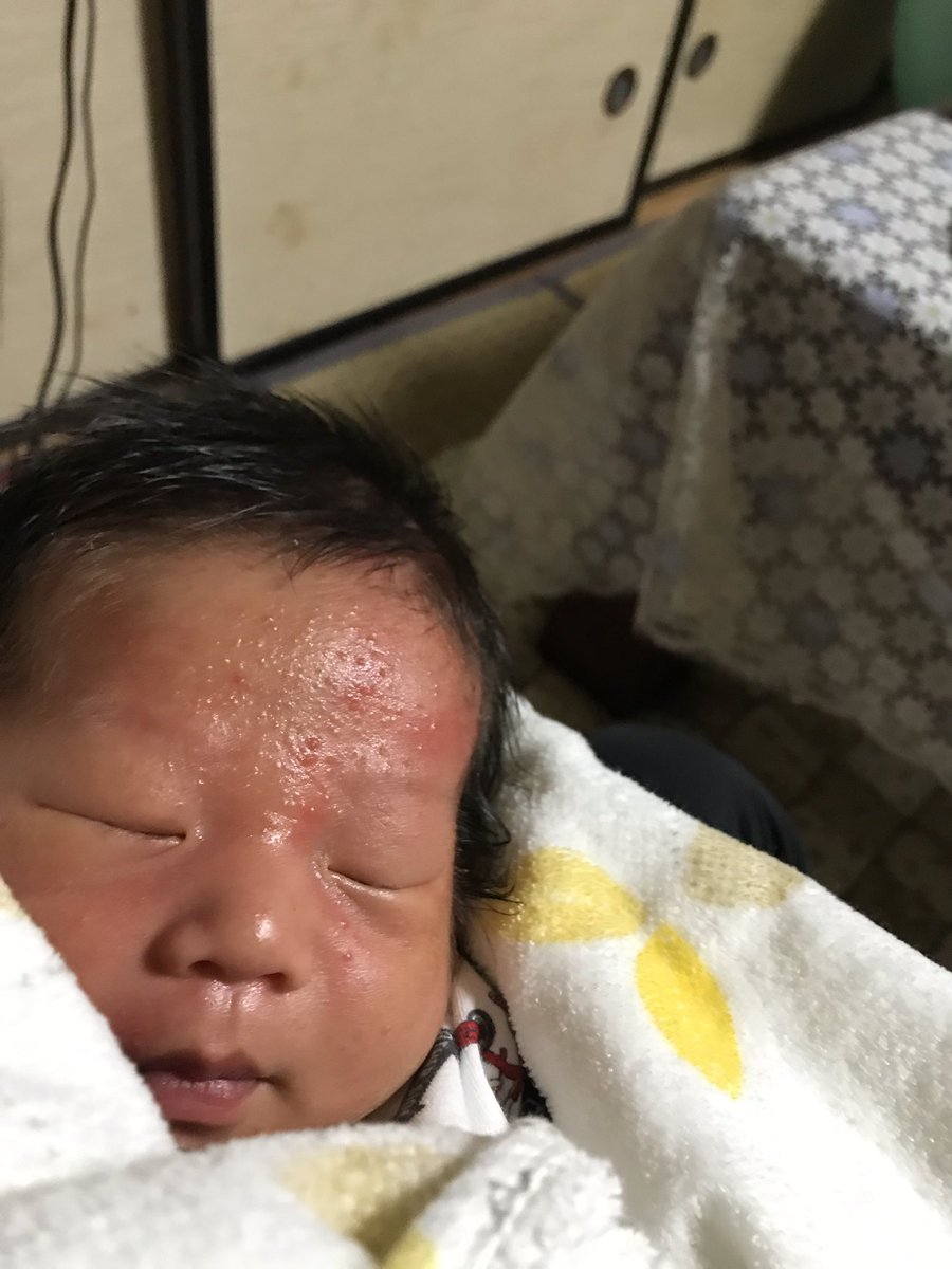 ট ইট র しげお あくらい 公式 しかし1ヶ月でここまで顔がパンパンに膨れるくらい太るとは想像してなかった ট ইট র しげお あくらい 公式 しかし1ヶ月でここまで顔がパンパンに膨れるくらい太るとは想像してなかった