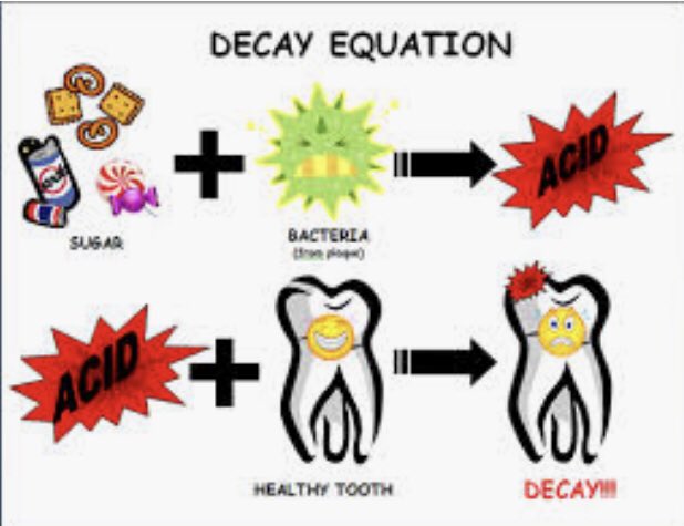 Sugar+Bacteria = Acid. 
Acid on tooth = Decay 🙈
Solution- less sugar, less plaque plus fluoride ✅ Brush twice a day for two minutes at a time, clean in between teeth daily with floss or interdental brushes and reduce your sugar intake with less snacking throughout the day. 🦠🦷