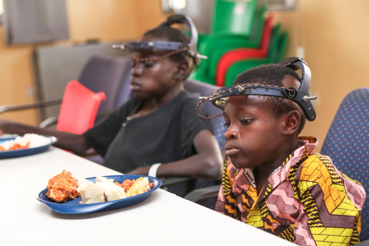 Patients in halos having lunch in the cafeteria.  Halos keep the spine stable before having surgery. #HaloTraction #Scoliosis #HelpTheWorldStandTall