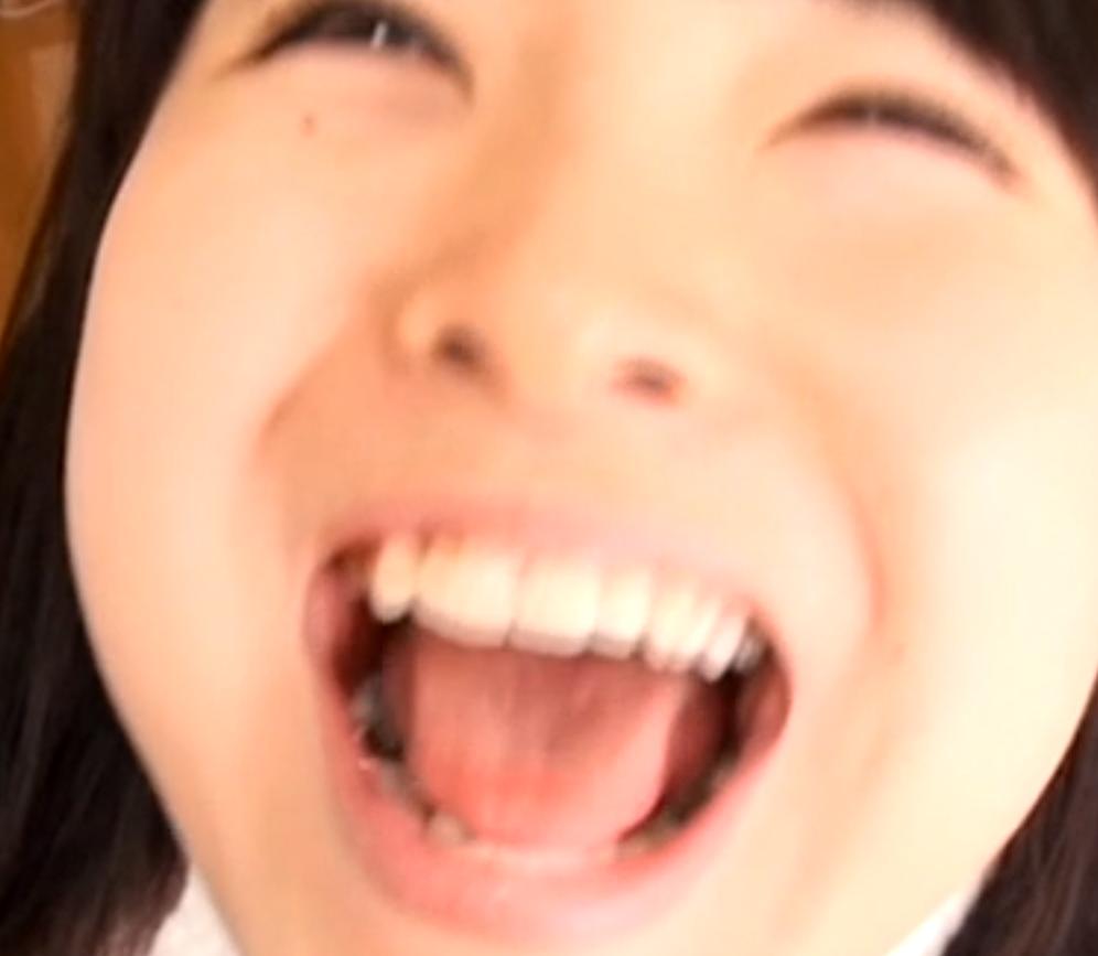 Loupis8f 口内 口腔 歯 銀歯フェチ Teeth Fetish ビーバー歯の可愛い 女の子です ごっくんするときに大きくお口をあ んして中を見せてくれます 上下左右６番インレー 上の歯４番左右インレーがありました 笑顔が可愛くておすすめ T Co