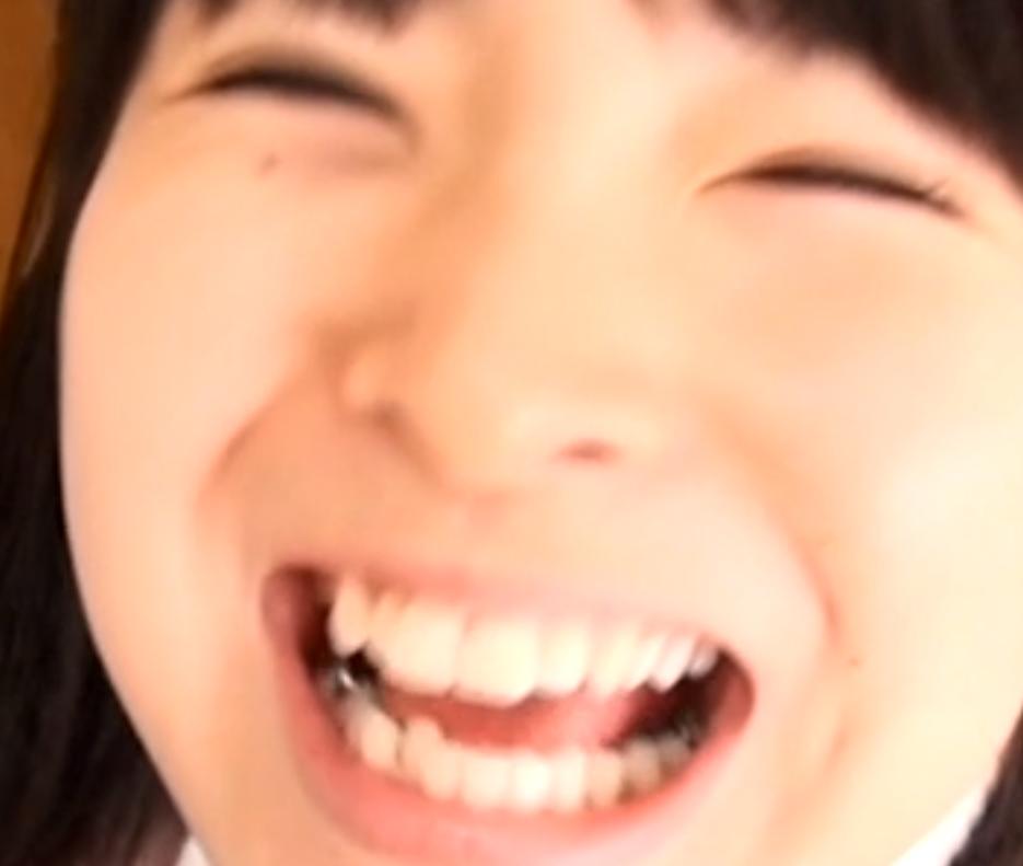 Loupis8f 口内 口腔 歯 銀歯フェチ Teeth Fetish ビーバー歯の可愛い 女の子です ごっくんするときに大きくお口をあ んして中を見せてくれます 上下左右６番インレー 上の歯４番左右インレーがありました 笑顔が可愛くておすすめ T Co