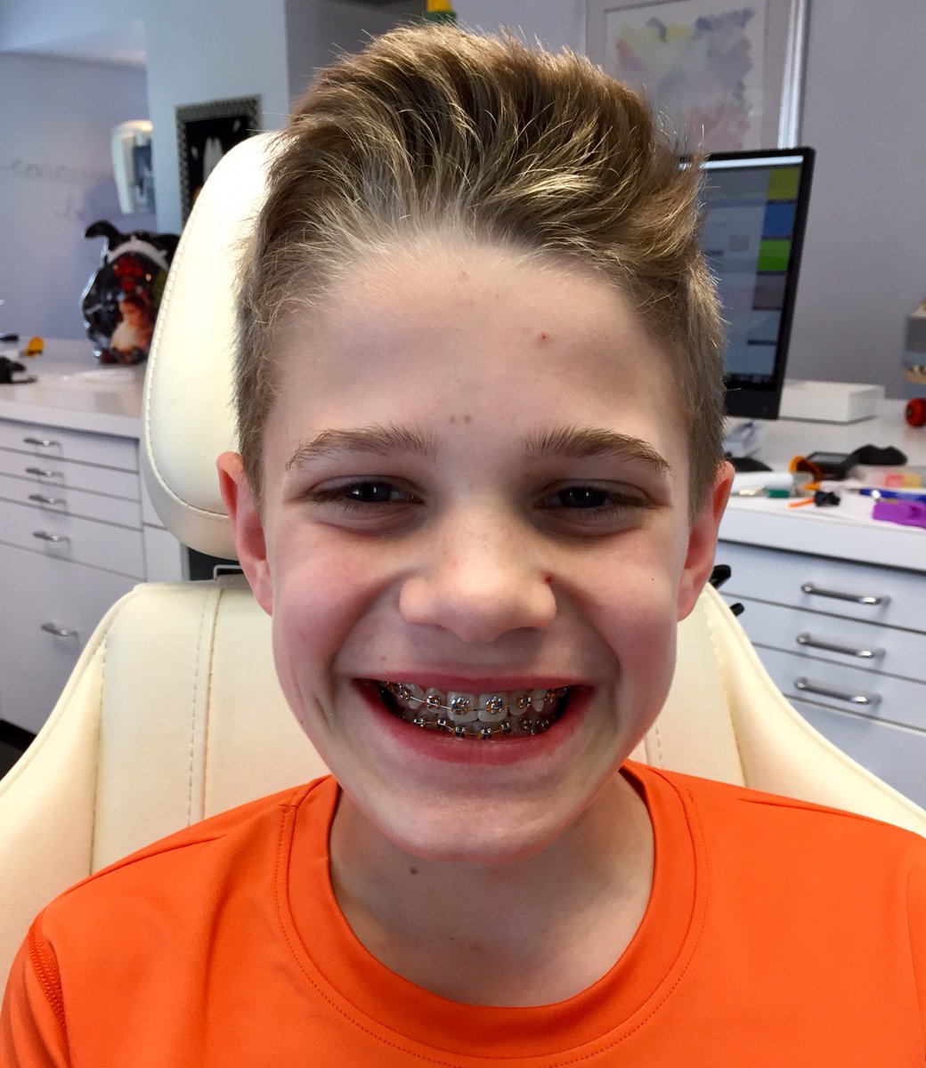 BracesOmaha's tweet photo. Congratulations today to Levi, who just got his braces on! Levi went with the Clemson Tigers @ Wildsmiles Braces! He can now show support for his favorite team with every smile. Go Tigers! #WildSmilesBraces #BracesOn https://t.co/Hi1a9xBgC5