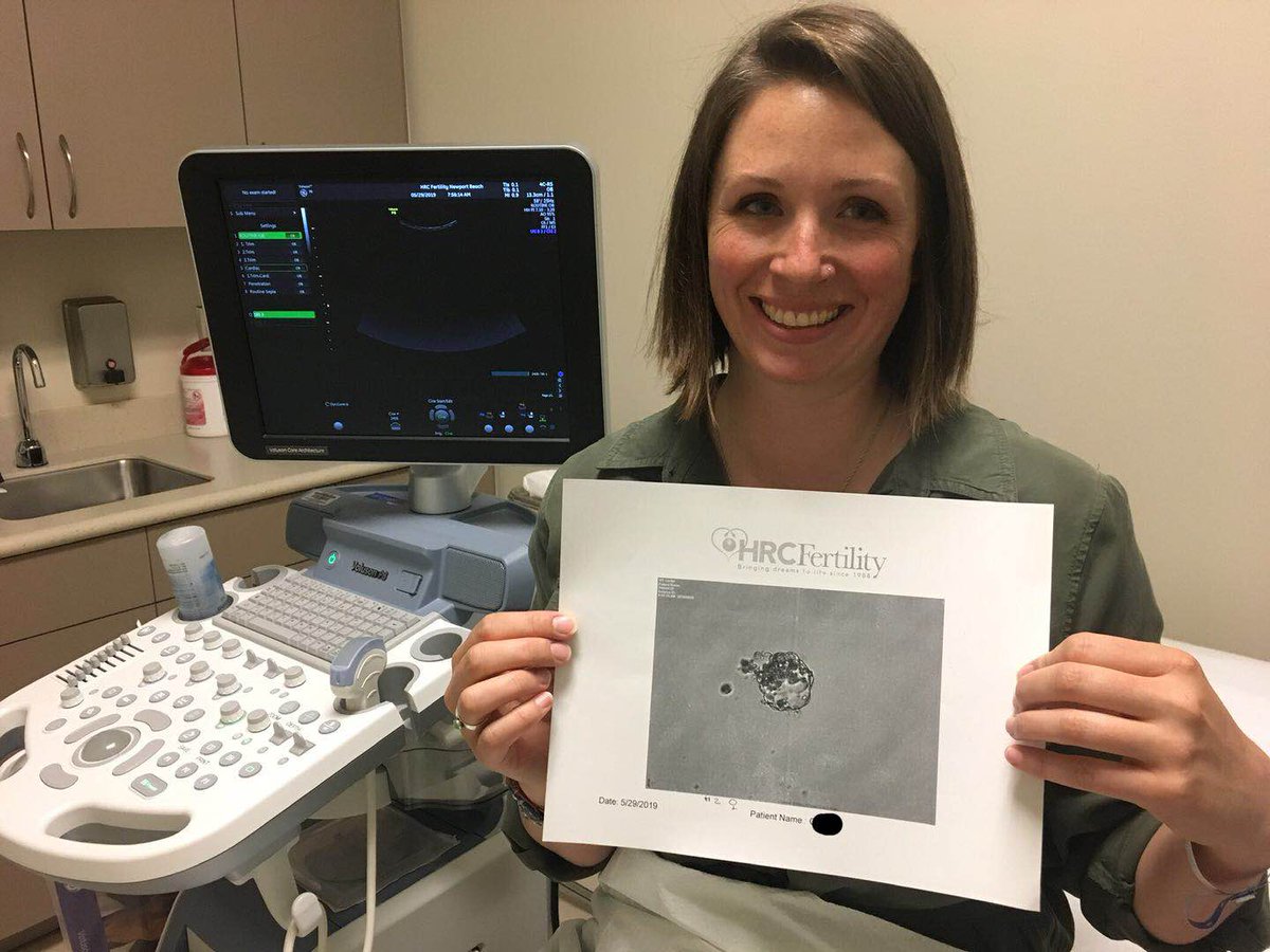 PacificSurro's tweet photo. Wishing lots of 👶🏻 dust and sticky thoughts to surrogate Katharine and her IP!!! So happy to accompany and witness their baby girl being transferred to Katharine in just less than 30 seconds! #surrogatemother #miracle #gestationalcarrier #stickythoughts #embryotransfer https://t.co/t7iNVnWc4y