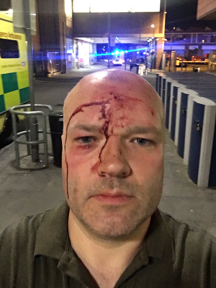 alastairjam's tweet image. Intervened in a nasty robbery and assault in Mile End Park and got a good shoeing for my troubles. Victim was rescued and is safe. Suspects at large but we have pictures. Other victims also ok. I’m getting checked out at A&amp;amp;E. I was the only 999 caller among crowd of gawpers.