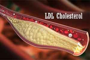 medicaldialogs's tweet image. #LDLCholesterol #Type2Diabetes #diabetes #neurology #cardiology @ACCinTouch @JAMANetworkOpen @JAMA_current @JAMANeuro @TheLancetNeuro @clincardiology @ESC_Journals @DiabetesUK Lower LDL-C leads to nerve damage in patients with type 2 diabetes: JAMA  | Speciality Medical Dialogues