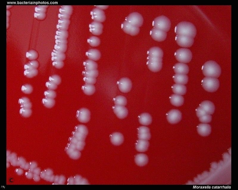 моракселла микробиология. Moraxella catarrhalis. моракселла катаралис идентификация. моракселла катаралис микробиология. моракселла катаралис на агаре.
