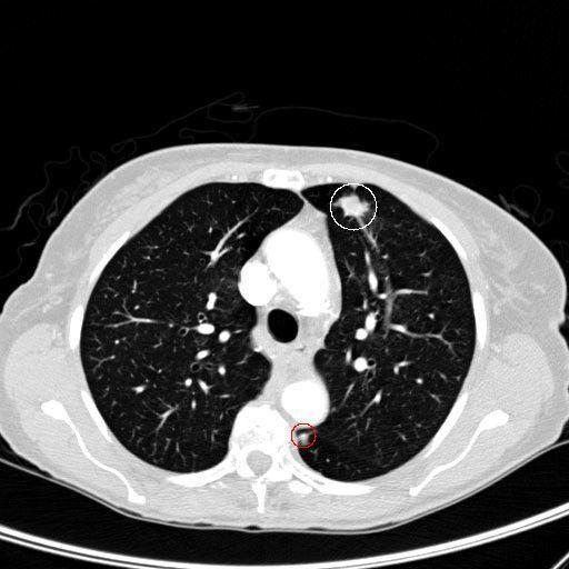 cvheady007's tweet photo. Doctors trained an algorithm to detect cancer in just 2 hours https://t.co/PQhwirZtyY  #health https://t.co/2TyUfkKXox