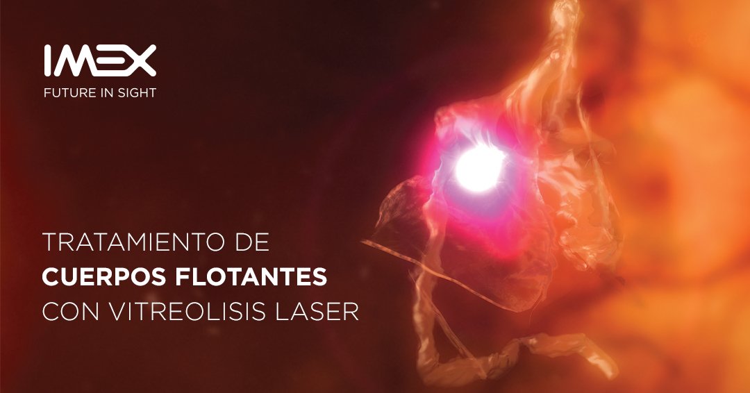 IMEXonline's tweet photo. TRATAMIENTO DE MIODESOPSIAS CON VITREÓLISIS LÁSER

La tecnología láser avanzada está cambiando el paradigma del tratamiento de opacidades vítreas.

LEER ARTÍCULO : https://t.co/Ns5MAbCFfW https://t.co/E9XM9UGGg7