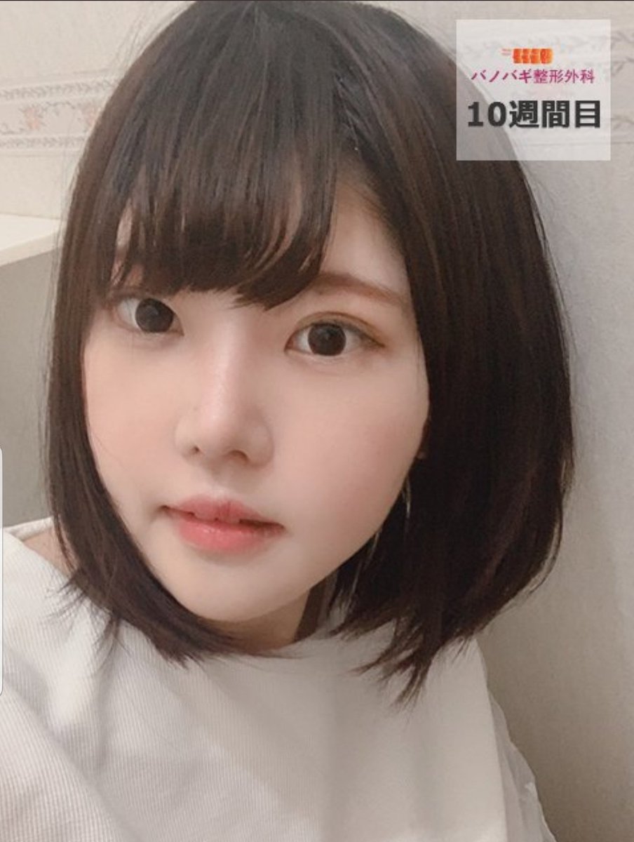 ナビコリア 韓国美容整形 無料サポート 08年から En Twitter バノバギ整形外科 輪郭3点 Vライン 頬骨縮小 切開目元矯正 鼻 6月中に手術を受ける方は 目 鼻 30 割引 輪郭 両顎 リフト 割引 Park Gyu Ri バノバギ 韓国整形 韓国両顎 ナビコリア 韓国美容整形 無料サポート 08年から En Twitter バノバギ整形外科 輪郭3点 Vライン 頬骨縮小 切開目元矯正 鼻 6月中に手術を受ける方は 目 鼻 30 割引 輪郭 両顎 リフト 割引 Park Gyu Ri バノバギ 韓国整形 韓国両顎