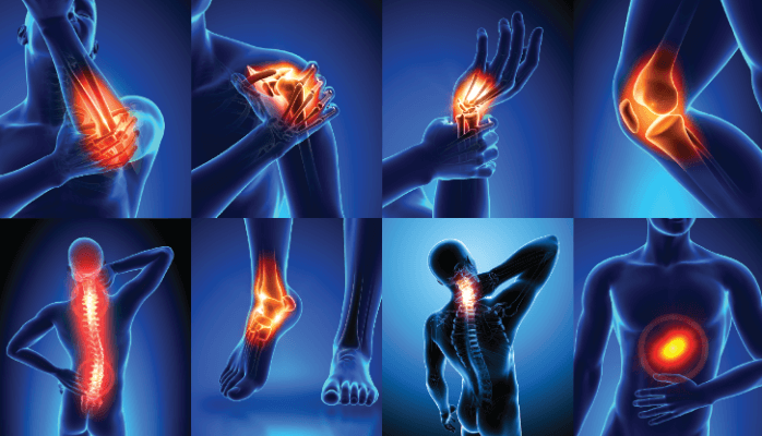 PainReliefJ's tweet photo. #Distressing feeling caused by intense or damaging stimuli is known as Pain. https://t.co/a1Qy5d8p6U