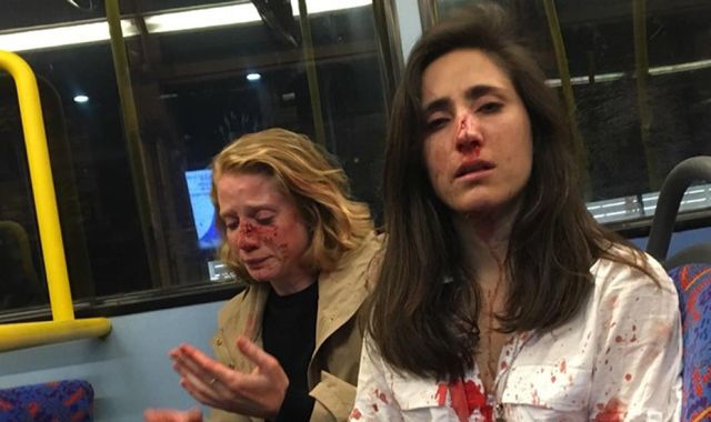GHR_SouthCoast's tweet photo. NEWS: Gay couple bloodied in attack on London bus after being asked to kiss.  https://t.co/91QzUum464 https://t.co/TP1UxvjV5q