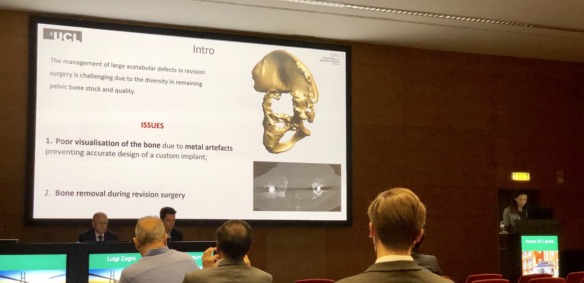 The_LIRC's tweet photo. An excellent series of talks given this morning by Anna, Sean and Lorenzo at @EFORTnet #EFORT2019 @Health_Eng @RNOHRIC @RNOHnhs @UCLEngineering @UCLDivofSurgery https://t.co/w4fieBzm4x