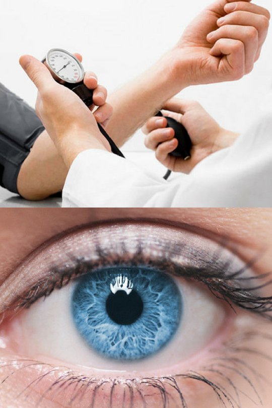 High blood pressure warning – do you see this sign in your eyes? Symptoms revealed hypertensioncardiology.wordpress.com/2019/06/07/hig…