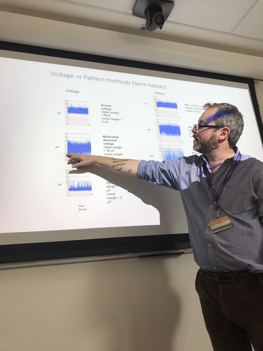 We also received a special talk on EEG/aEEG in infants born with HIE by specialist Sean Mathieson @CUH_Cork @UCC @infantcentre @nbcirl #everybabycounts #uccnews #education #clinical