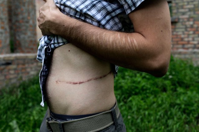 EPISODE 66: ORGAN THEFT IS OUT NOW!!!!! We’re talking the myth, it’s origin, and the very real organ black market.