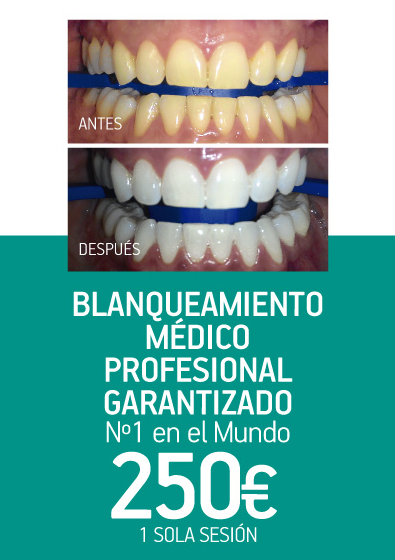 DentalPinatar's tweet photo. Nuevo Post Centro Dental Pinatar Blanqueamiento Dental https://t.co/VNRI3UCI6M https://t.co/ppmWIlSCcw