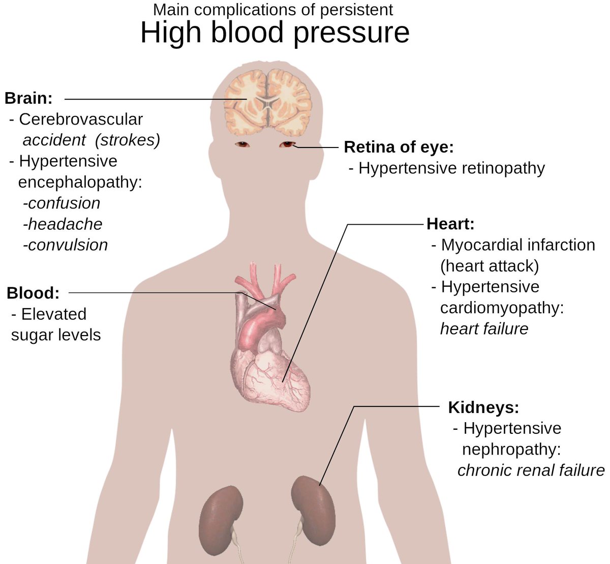 Hypertension causes due to contraceptive medication, Old age, Unhealthy Lifestyle, Tobacco and Alcohol, Sleep problems, Excessive salt consumption, Family History, Obesity.
bit.ly/2V7BGNu
#bloodpressure #hypertension