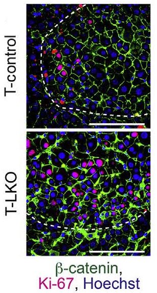 Polyploid Hepatocytes Facilitate Adaptation and Regeneration to Chronic Liver Injury, new from <a href="/ASIPath/">American Society for Investigative Pathology</a> member Andrew Duncan and colleagues from <a href="/UPMC/">UPMC</a> (<a href="/UPMCnews/">UPMC</a>).  Full text: ajp.amjpathol.org/article/S0002-…