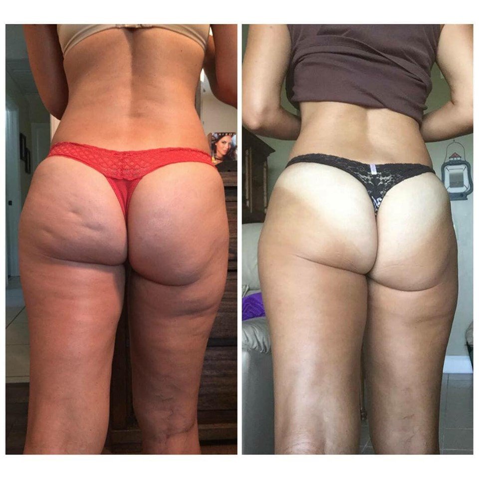 realashleyblack's tweet photo. HEARTBUTT CHALLENGE IS COMING! Get your supplies: https://t.co/emPg1S7BcA ❤🍑

#HeartButt is about growing #muscles and reducing fat! Full #glutes are the key to smooth glutes!!! It’s time to #BuildAButt and use the #FasciaBlaster all around! https://t.co/oKMXoHAmX7