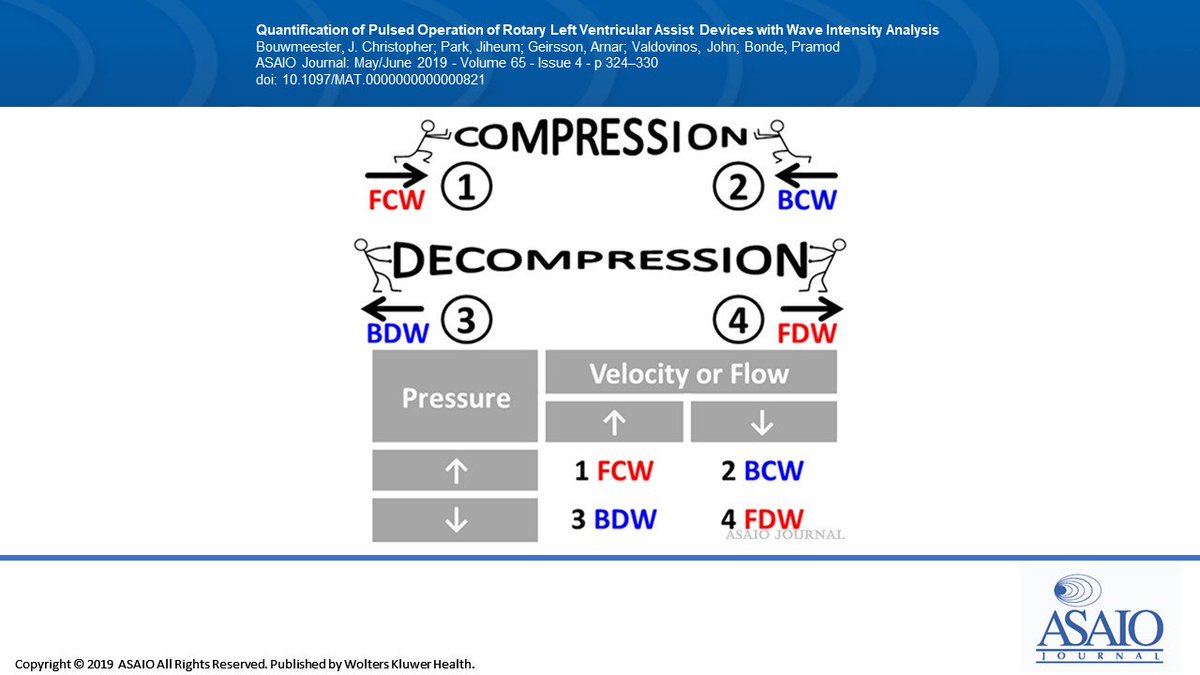 asaiojournal's tweet image. Quantification of Pulsed Operation of Rotary Left Ventricular Assist Devices with Wave Intensity Analysis
ow.ly/oPvD50uz89C
@YaleMed @ibbme_uoft @csunorthridge 

#LVAD #artificialheart #pulsatility