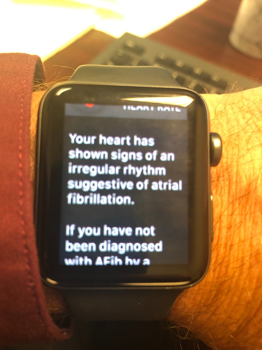 George H Crossley (@vandyrhythmdoc) on Twitter photo My first referral from an Apple Watch. My first referral from an Apple Watch.