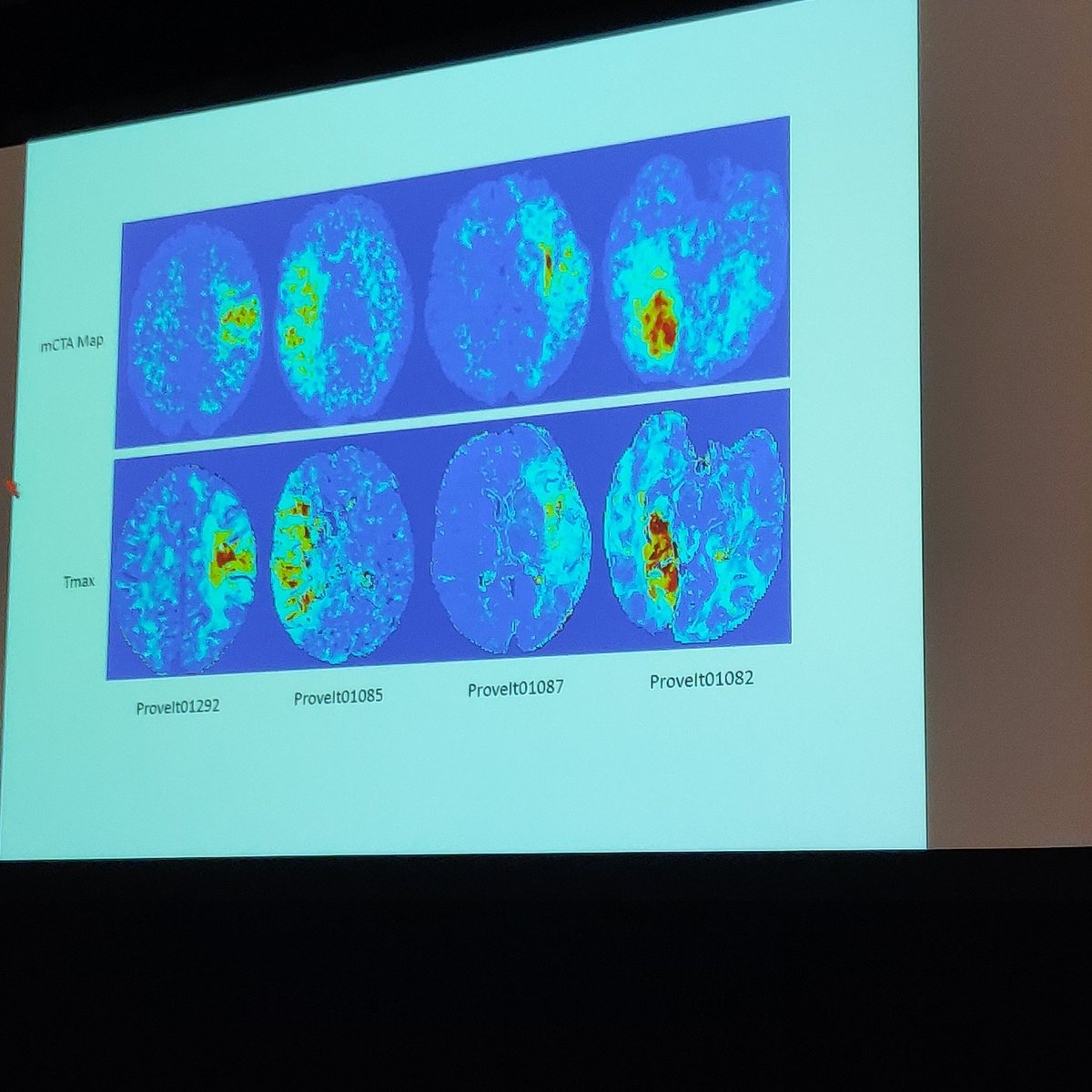 MPeyT1's tweet photo. Start of the 5T meeting with a talk from @mayank_G0 on "What we don't know" #5T19 #GTFVO #stroke treat more patients! treat them faster! https://t.co/udgJyNK8W6