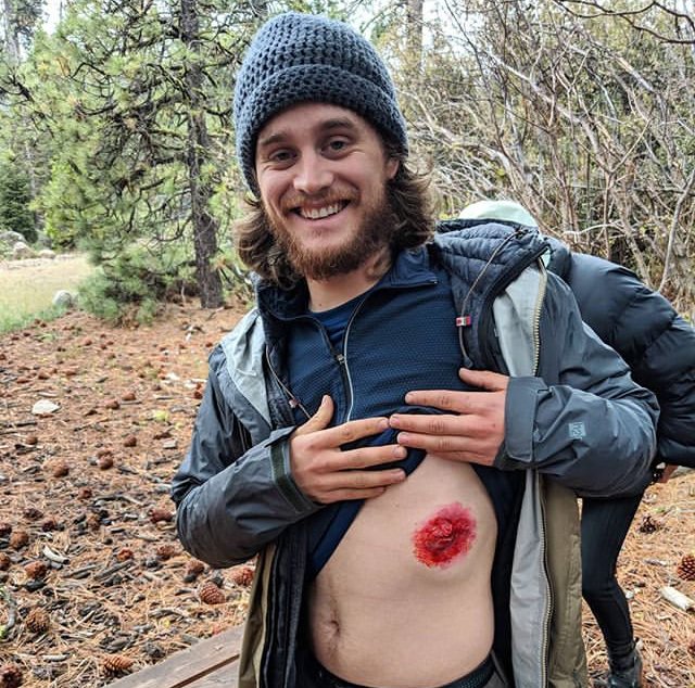 Don't worry, it's fake!  Training like it's real is an important part of learning how to be prepared for an emergency. Our instructors use moulage to build fake wounds so students get experience managing life-like injuries in remote environments, with limited resources.