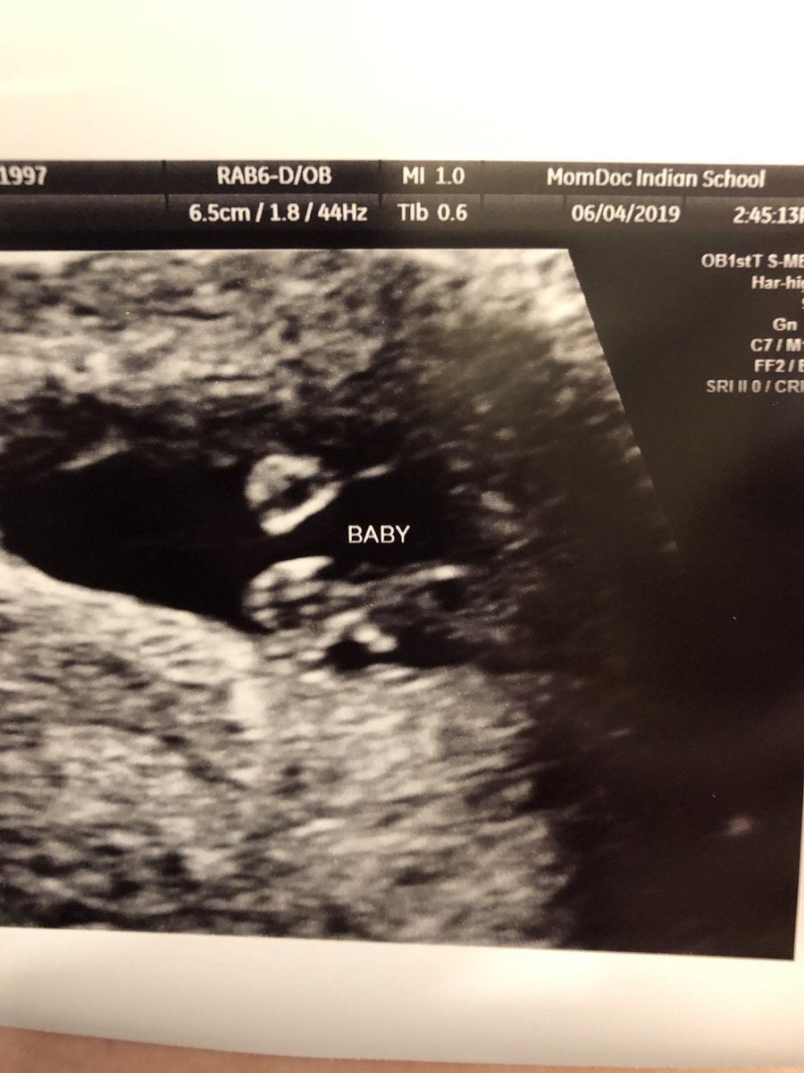bpdelp's tweet photo. Because now I’m a mommy of two 👶🏼👶🏼 https://t.co/z1t37Doxfx