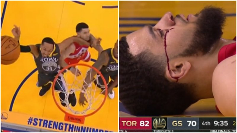 【影片】太恐怖！范喬丹遭肘擊眼角一行血直流下，牙都掉出來啦！-黑特籃球-NBA新聞影音圖片分享社區