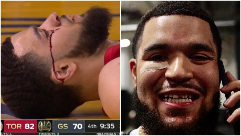 范喬丹賽後曬牙圖,遭Drake調侃:我的雙胞胎兄弟用我的醫療保險吧!-黑特籃球-NBA新聞影音圖片分享社區