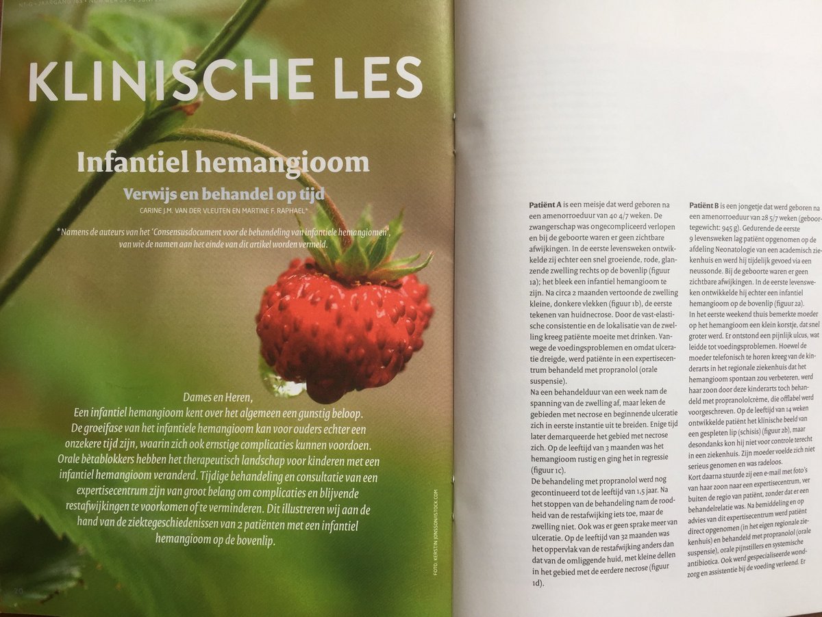 Trots op onze mooie #klinischeles ⁦@NTvG_actueel⁩ ⁦over⁩ #infantielhemangioom #verwijsenbehandeloptijd. Coproductie van de 4 samenwerkende expertisecentra voor aangeboren vaatafwijkingen #Wevar #Cavu #Ava ⁦<a href="/HecovanNijmegen/">C. van der Vleuten</a>⁩ &amp; ⁦@HevasNederland⁩