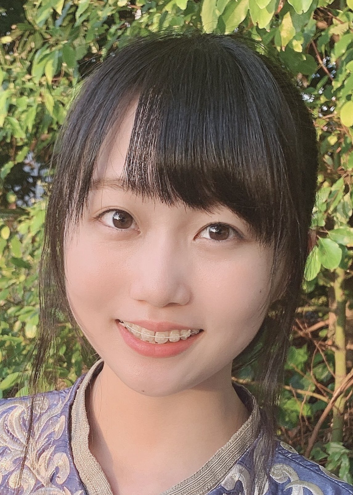 歯歯歯の歯 昨日に続き乃木坂4期生から 矢久保美緒 さん 歯列矯正組だったんですねー 嬉しいです 綺麗な歯並びになって美しくなっていくのがいいですね 歯歯歯の歯 昨日に続き乃木坂4期生から 矢久保美緒 さん 歯列矯正組だったんですねー 嬉しいです 綺麗な歯並びになって美しくなっていくのがいいですね