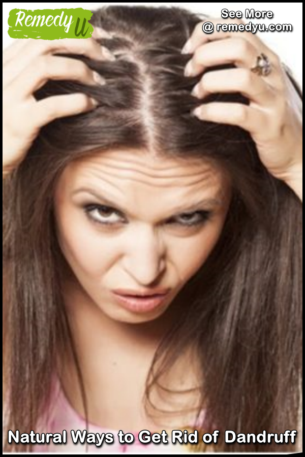 Засаленные волосы. Волосы капризные. Волосы капризные. Выпадение волос у женщин. Стресс и волосы.