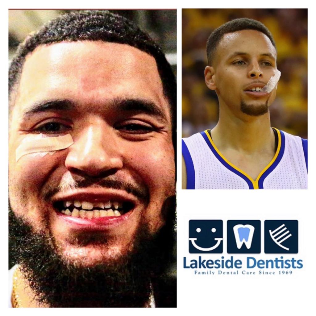 Hey <a href="/FredVanVleet/">Fred VanVleet</a>, we’ll fix your tooth for free and give you a mouth guard too. Just don’t wear it like this <a href="/stephencurry30/">Stephen Curry</a> #wethenorth #goraptors #nbafinals #mimicodentist #LakesideDentists