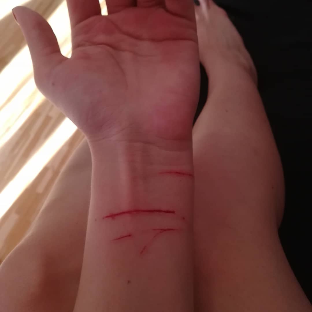 YumiRaion's tweet photo. Never mess with a mad kitty πΎππΏ
#cat #madkitty #scratches #pain https://t.co/AfHiISyctF