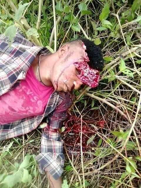Fombat2's tweet photo. [08/06 18:52] +237 : Ekona 
[08/06 18:52] +237: Today this is what Paul Biya's military did to an innocent civilian. Fombat plz share!! @UN @UKParliament @AsstSecStateAF @mbachelet @POTUS @RoyalFamily @theresa_may @jeremycorbyn @UKHouseofLords #StopTheGenocideInSouthernCameroons https://t.co/5gROc2RTs9