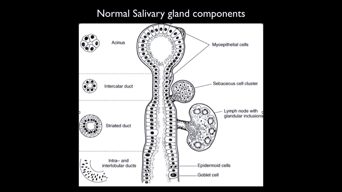 rdpatho's tweet photo. Salivary gland tumors - origin &amp; IHC https://t.co/KQ5qPbX006