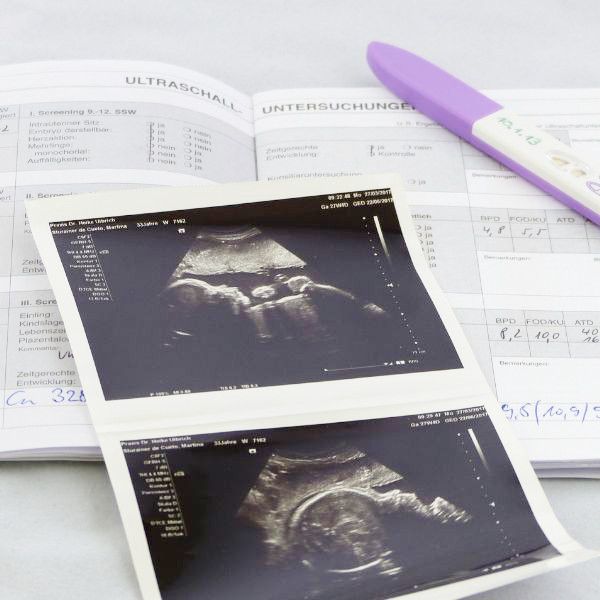 Der #Mutterpass, einfach erklärt: buff.ly/2KDK1GU #schwanger #schwangerschaftsvorsorge