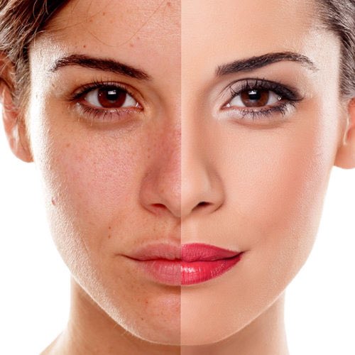IranToursMCN's tweet photo. Laser treatment in Iran for skin rejuvenation &amp; hair removal at modern clinics at lower price.            #iran #irantoursmcn #tour #tours #tourism #travel #medical #medicaltourism #laser https://t.co/unpPR68GYs