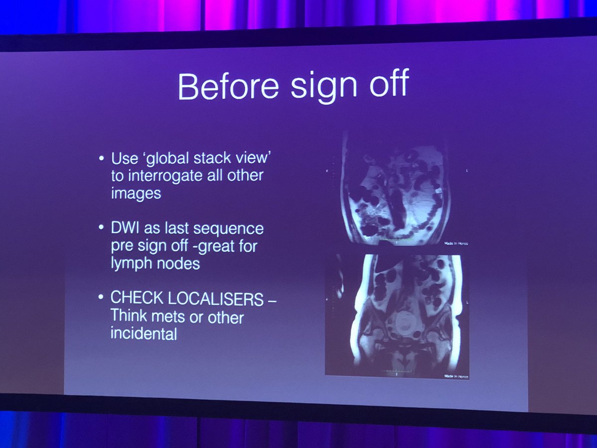 dazman78's tweet photo. Really insightful overview of liver assessment in #MRI from @JosephMullineux @UKIOCongress Always good to see what radiologists are looking for. Use of cross sectional LIRADS #structuredreports Plus, remember the localisers! 👨🏼💻👩🏼💻 https://t.co/ASXgII1nx2