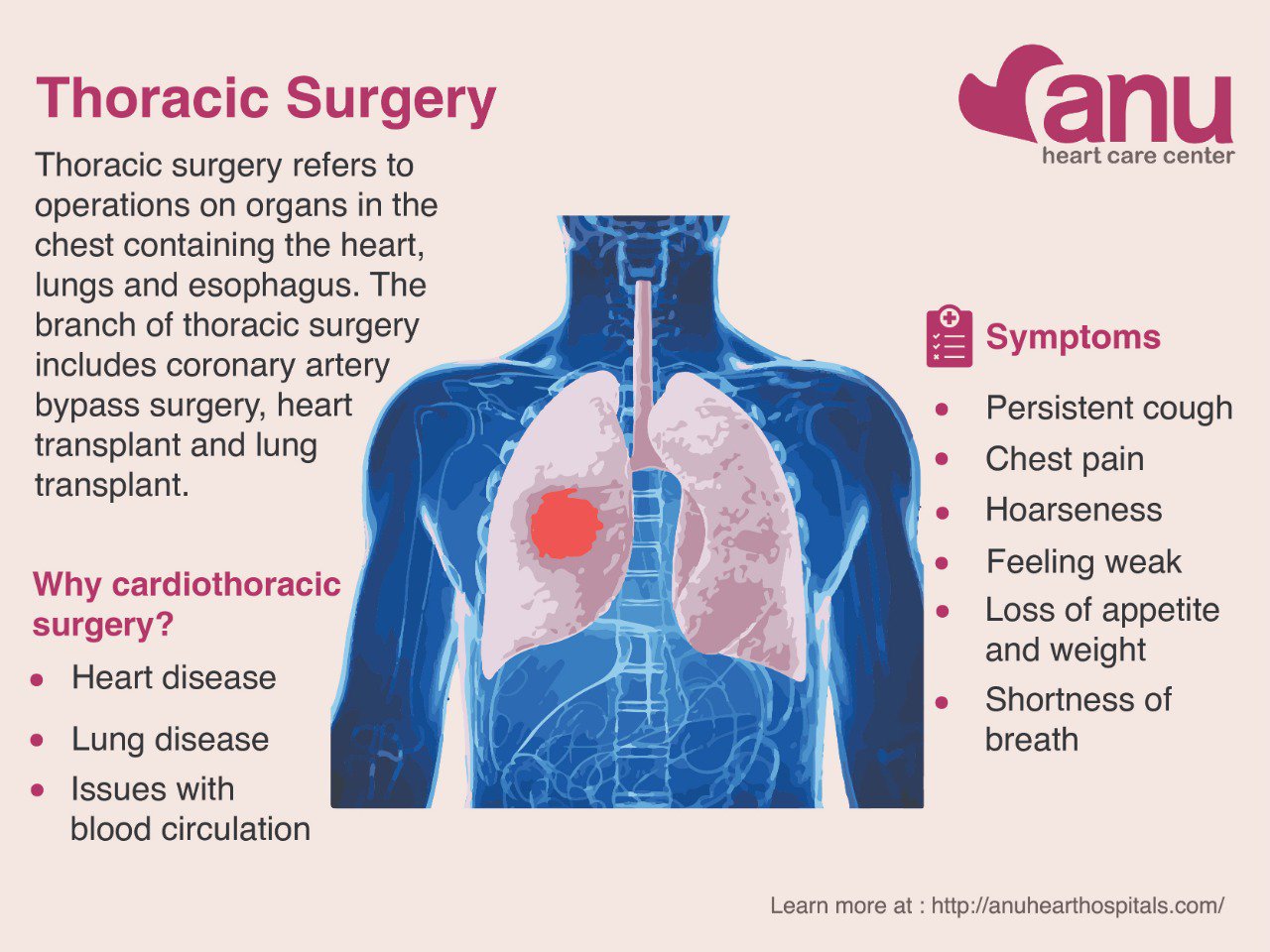 Anu hospitals on twitter thoracic surgery symptoms persistent cough