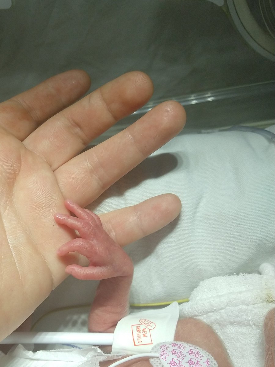 rubilestrange's tweet photo. Y bueno ellos tienen un buen de ganas de vivir y yo tengo la oportunidad de ayudarles y a la vez ellos me dan todo el apoyo a mí sin darse cuenta... 😍 #neonatos #neosrules https://t.co/uZrxsrnCMg